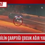 Tekirdağ: Otomobilin Çarptığı Çocuk Ağır Yaralandı