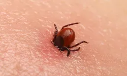 Kene Can Aldı! Peki Kene Nasıl Çıkarılmalı?