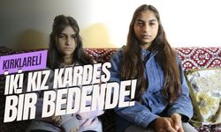 KIRKLARELİ; İki Kız Kardeş Bir Bedende!