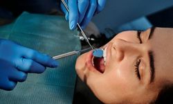 Diş Eti Çekilmesinin En Büyük Sebebi Diş Taşı!