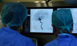 Kötü Kolesterol Kalp Krizine Neden Olabilir!