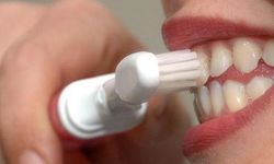 Diş Beyazlatmada Doğru Bilinen Yanlışlar!