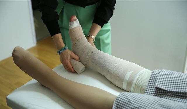 Lenfödemin Tedavisinde Gecikmeyin!