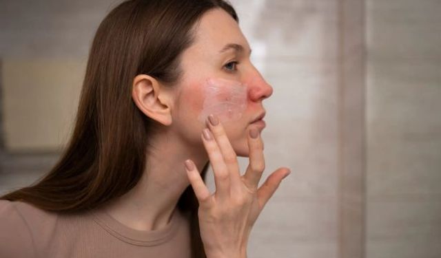 Soğuklarda Cilt Kuruluğuna Karşı 10 Tavsiye