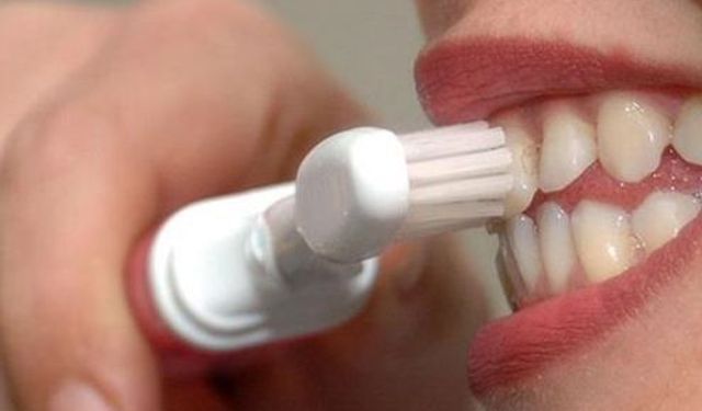 Diş Beyazlatmada Doğru Bilinen Yanlışlar!