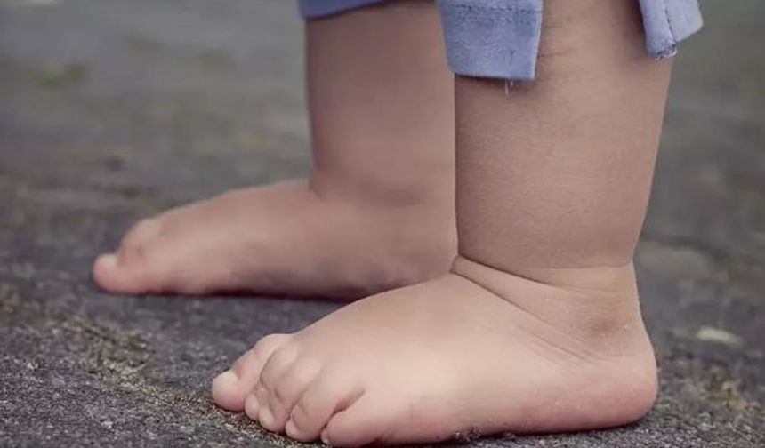 Çocuklarda Obezite Düztabanlık Nedeni!