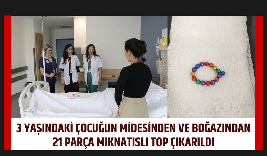 3 Yaşındaki Çocuğun Midesinden ve Boğazından 21 Parça Mıknatıslı Top Çıkarıldı